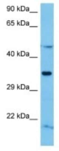 Olfactory receptor 488 Rabbit anti-Mouse, Polyclonal, Novus Biologicals